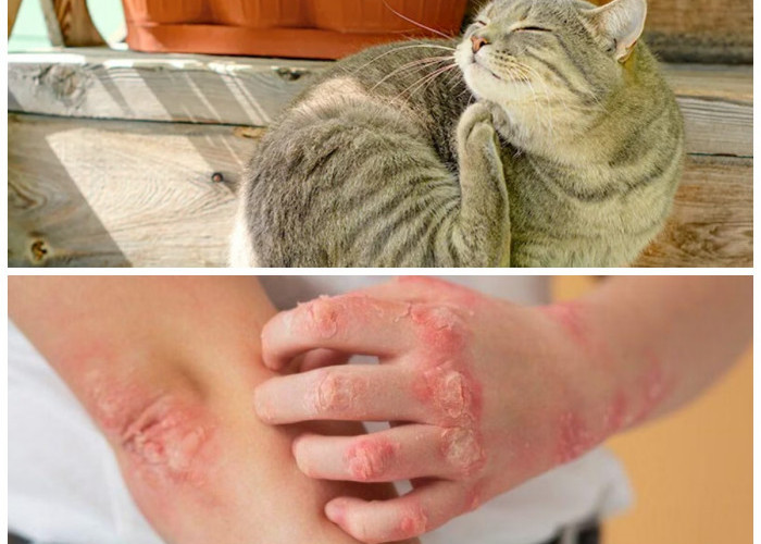 Waspada! Ini Ciri-Ciri Gigitan Kutu Kucing pada Manusia yang Perlu Kamu Kenali