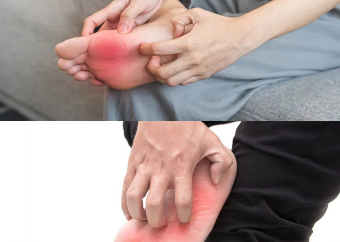  Telapak Kaki Gatal? Ini Penyebab Yuk Simak !