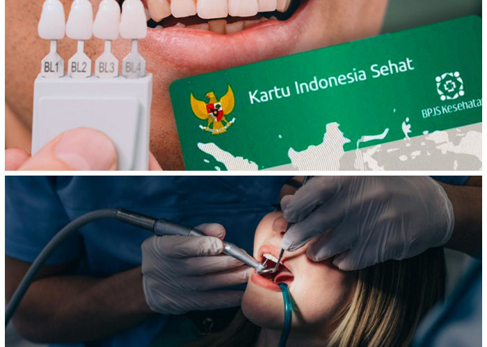 Gratis! 7 Perawatan Gigi yang Ditanggung BPJS Kesehatan, Mulai dari Tambal hingga Pasang Gigi Palsu