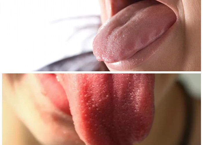 Rasa Manis di Mulut? Kenali Penyebab, Risiko, dan Solusi Medis yang Tepat