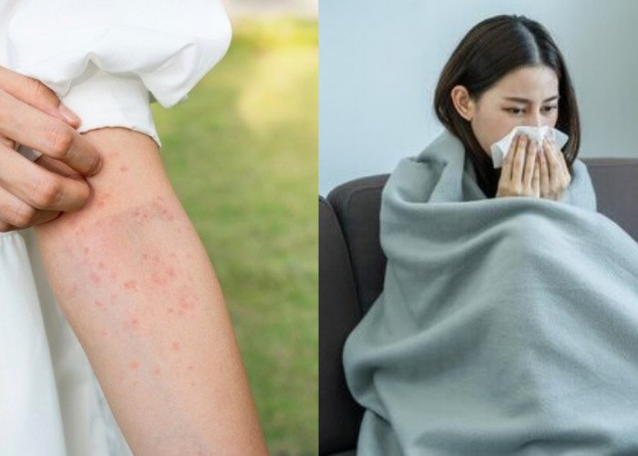 Yuk Kenali Gejala dan Cara Mengatasi Alergi Udara!