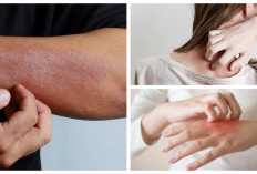 Jangan Anggap Remeh! Kulit Kering dan Gatal Bisa Jadi Tanda 8 Masalah Kesehatan Serius