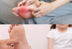 sangat Mengganggu Kenyamanan, Kenali Faktor Pemicu Gatal di Telapak Kaki dan Cara Mengobatinya!