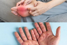 Sering Gatal di Tangan dan Kaki Tanpa Sebab? Ini 7 Kemungkinan Penyebabnya