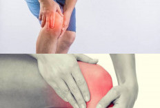 Sering Sakit Lutut Saat Jongkok? Ini 9 Penyebab Utama dan Cara Mengatasinya