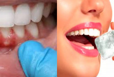 5 Faktor Penyebab Gusi Berdarah dan Solusinya