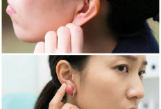 Kenapa Muncul Benjolan di Daun Telinga? Ini Penyebab dan Cara Mengatasinya!