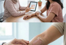 Cangkok Kulit, Proses Memindahkan Kulit untuk Menutupi Luka yang Terbuka