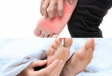 Bukan Cuma Kutu Air! Ternyata Ini 4 Faktor Utama Penyebab Telapak Kaki Gatal Tak Tertahankan