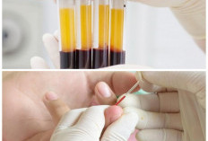 Fakta Menarik Golden Blood: Golongan Darah Paling Langka yang Dimiliki Segelintir Orang