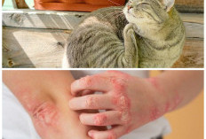 Waspada! Ini Ciri-Ciri Gigitan Kutu Kucing pada Manusia yang Perlu Kamu Kenali