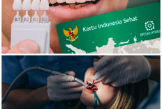 Gratis! 7 Perawatan Gigi yang Ditanggung BPJS Kesehatan, Mulai dari Tambal hingga Pasang Gigi Palsu
