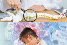 Tips Menjaga Kepadatan Tulang agar Terhindar dari Osteoporosis, Terapkan Gaya Hidup Sehat Sejak Dini